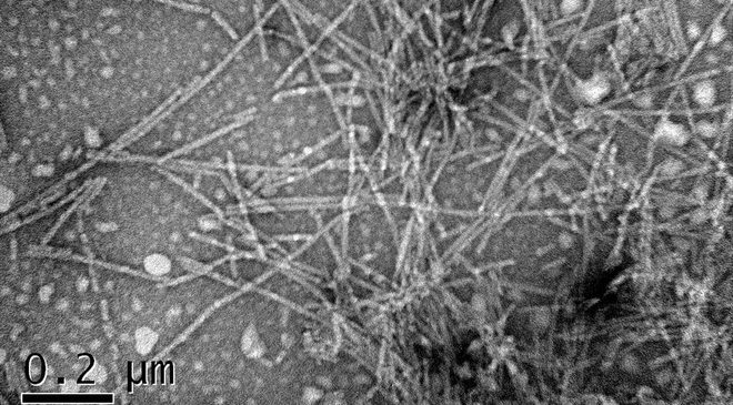 Una nueva investigación liderada por el Institut de Biotecnologia i de Biomedicina (IBB) de la Universitat Autònoma de Barcelona apunta directamente a una pequeña molécula conocida como SynoClean-D como posible freno a los procesos de neurodegeneración en modelos animales.