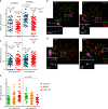 Dr. I. Roig : ATR is required to complete meiotic recombination in mice