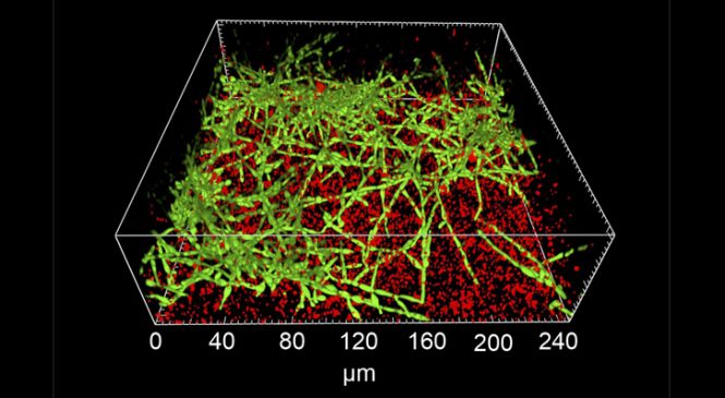 Noves molècules que inhibeixen la formació de biofilm per diversos patògens oportunistes