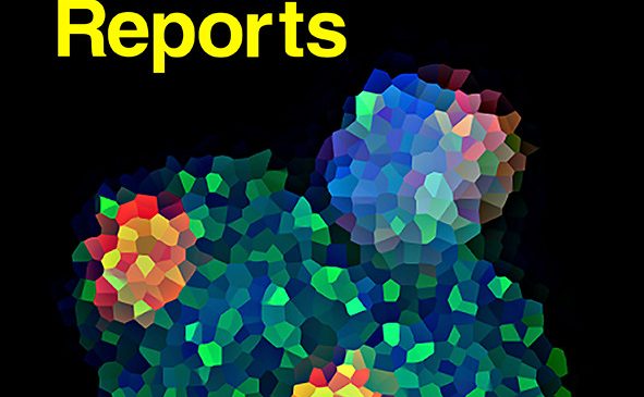 Dra. Aurora Ruiz-Herrera: Three-Dimensional Genomic Structure and Cohesin Occupancy Correlate with Transcriptional Activity during Spermatogenesis