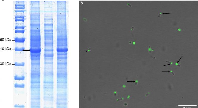 Protein Folding and Conformational Diseases “Coiled-coil inspired functional inclusion bodies”