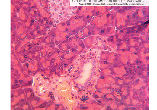 Celular Immunology: “Interleukin-13 Pathway Alterations Impair Invariant Natural Killer T-Cell-Mediated Regulation of Effector T Cells in Type 1 Diabetes”